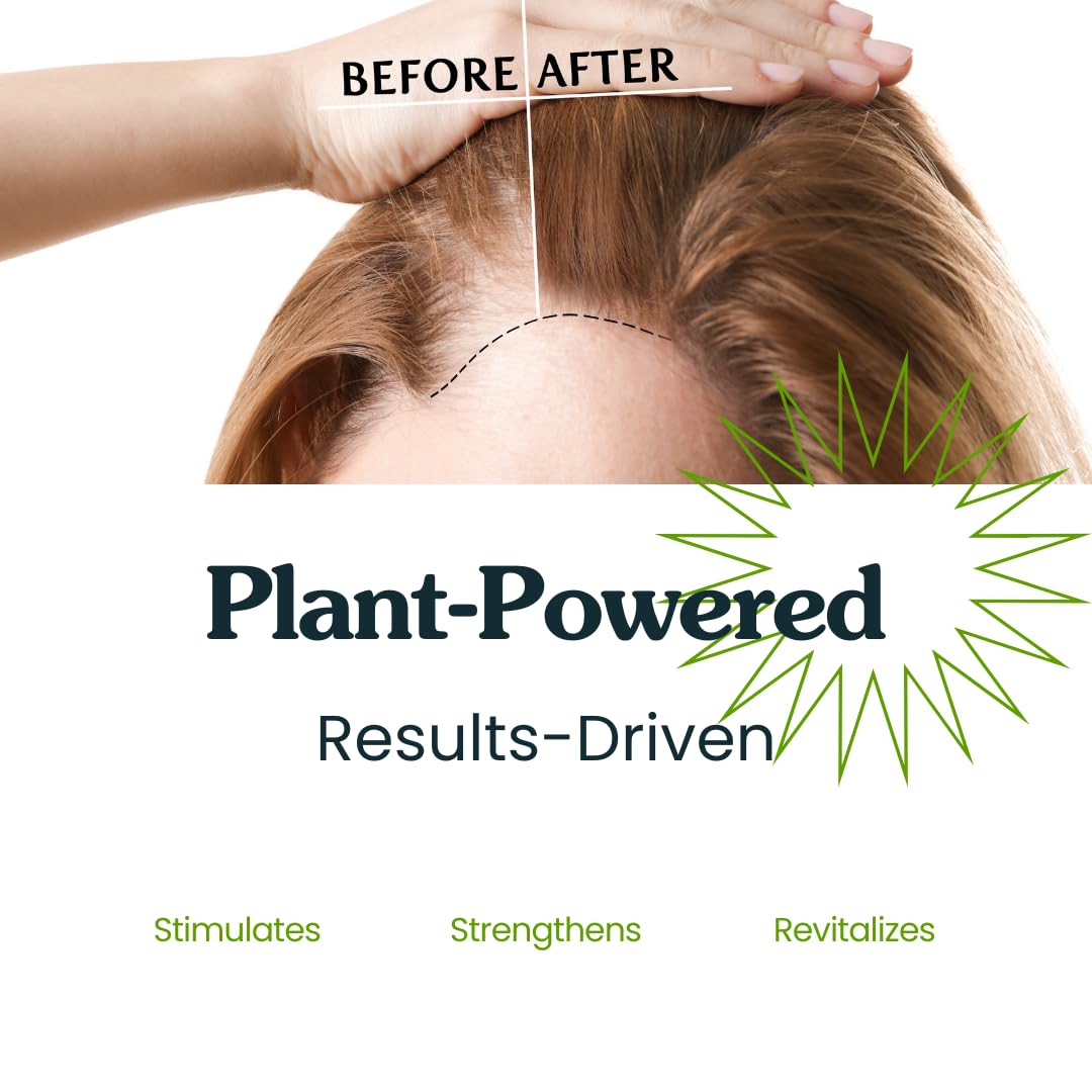 Clearly GAIN, Hair Growth Oil and Thickening Scalp Treatment for Men and Women | Natural Herbal Serum with Castor, Jojoba, Clary Sage, Rosemary, Nettle for Hair Loss, Alopecia, Thinning Hair