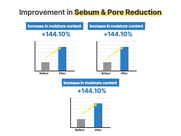 AQUA SQUALANE SERUM | Deeply hydrated Facial Serum for All Skin Type, Soothing, Pore Tightening and Sebum control Benefits, Korean Skin Care (1.69 Fl.Oz)
