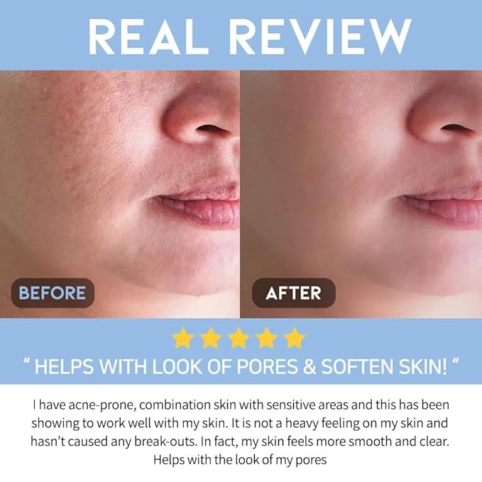 AHA BHA Serum Korean Overnight Face Serum, Acne Serum for Oliy & Sensitive Skin, Exfoliating Face Serum P.M, AHA BHA PHA, Papain, Cell Turnover Refine Serum Cream 50g