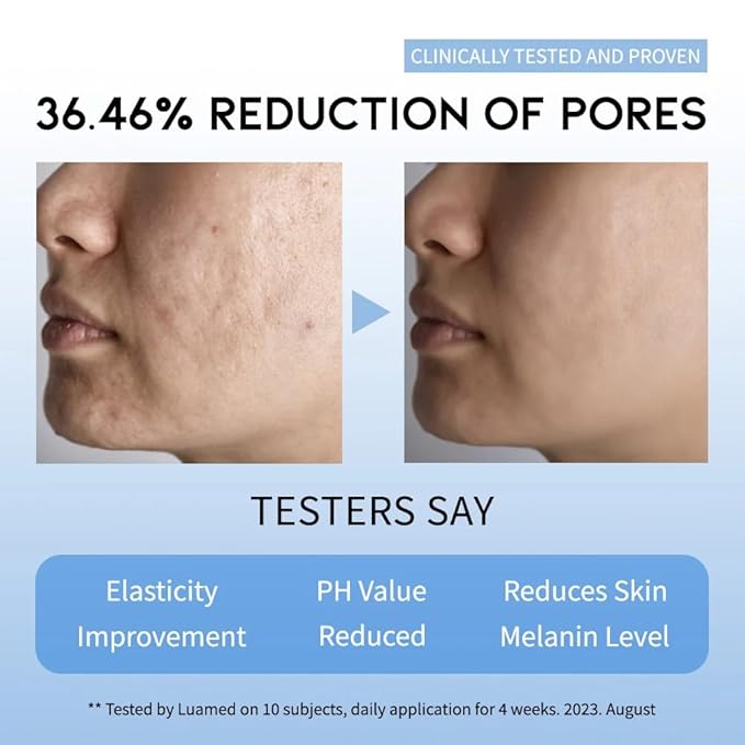 AHA BHA Serum Korean Overnight Face Serum, Acne Serum for Oliy & Sensitive Skin, Exfoliating Face Serum P.M, AHA BHA PHA, Papain, Cell Turnover Refine Serum Cream 50g