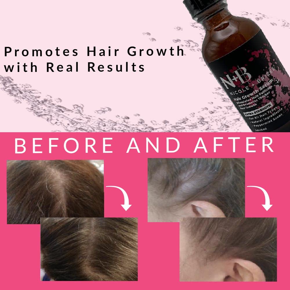 N+B Hair Growth Serum - Helps Promote Thicker, Fuller, & Healthier Hair w/Biotin, Natural-Based Formula, Helps Prevent Hair Fall & Thinning, For Women In All Hair Types - (2oz.) (3-Pack)