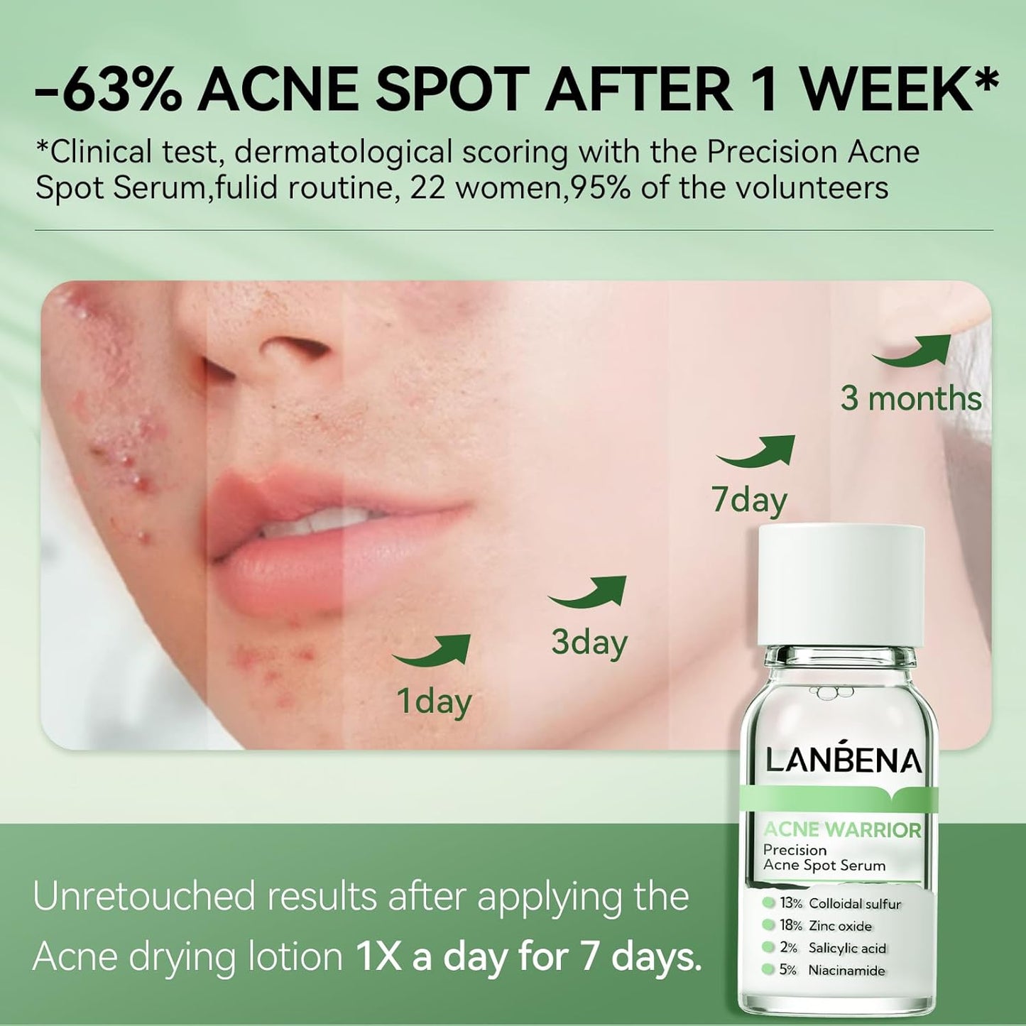 LANBENA Precision Acne Spot Serum, Acne Drying Lotion, Overnight Acne Treatment For Face, Dry Out Pimples, Blemishes, Zits And Clean Pores, 0.42 Fl Oz
