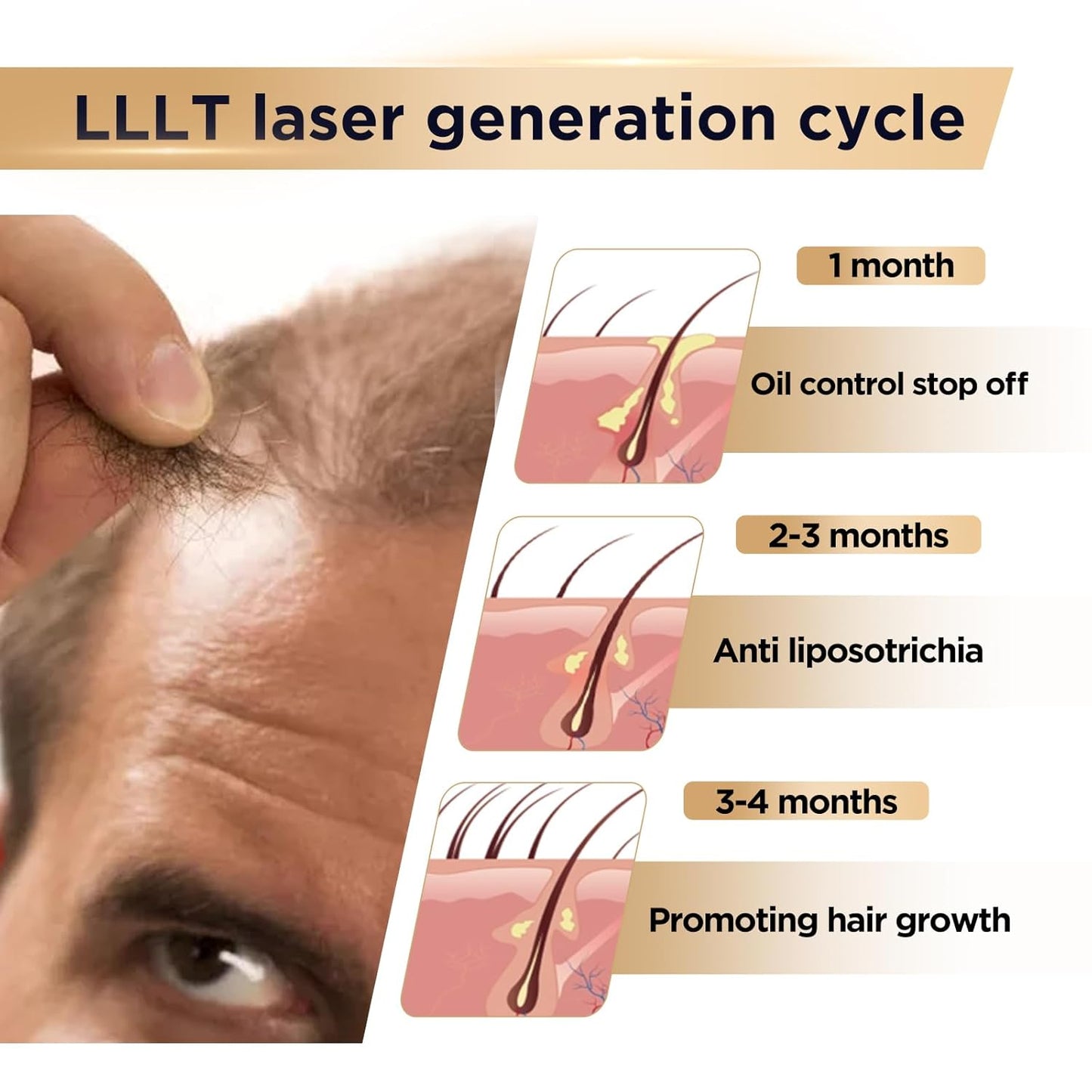 Red Light Therapy for Hair Growth Device - FDA Cleared Hair Loss Treatment - Laser Cap for Hair Regrowth - Hair Thinning & Alopecia Treatment for Men & Women