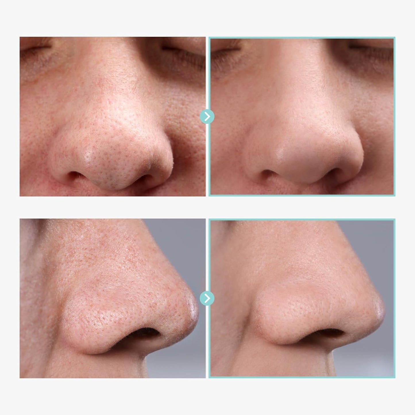 Pore Tightening Serum, Instantly Reduces Pores, Smooths Skin & Strengthens Barrier, Formulated With Niacinamide & Allantoin, Pore Minimizer For Face, Korean Skin Care, 30ml, 1.01 fl. oz.