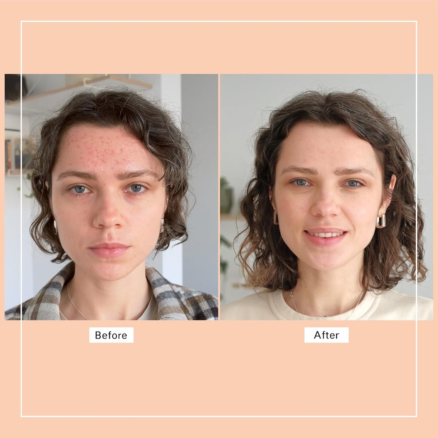 Wellness Heavens Vitamin C Serum for Face, Anti Aging Collagen Peptide Face Serum with Niacinamide & Vitamin E for Dark Spot, Brightening, Moisturizing, Smoothing, Firming, 30 ml