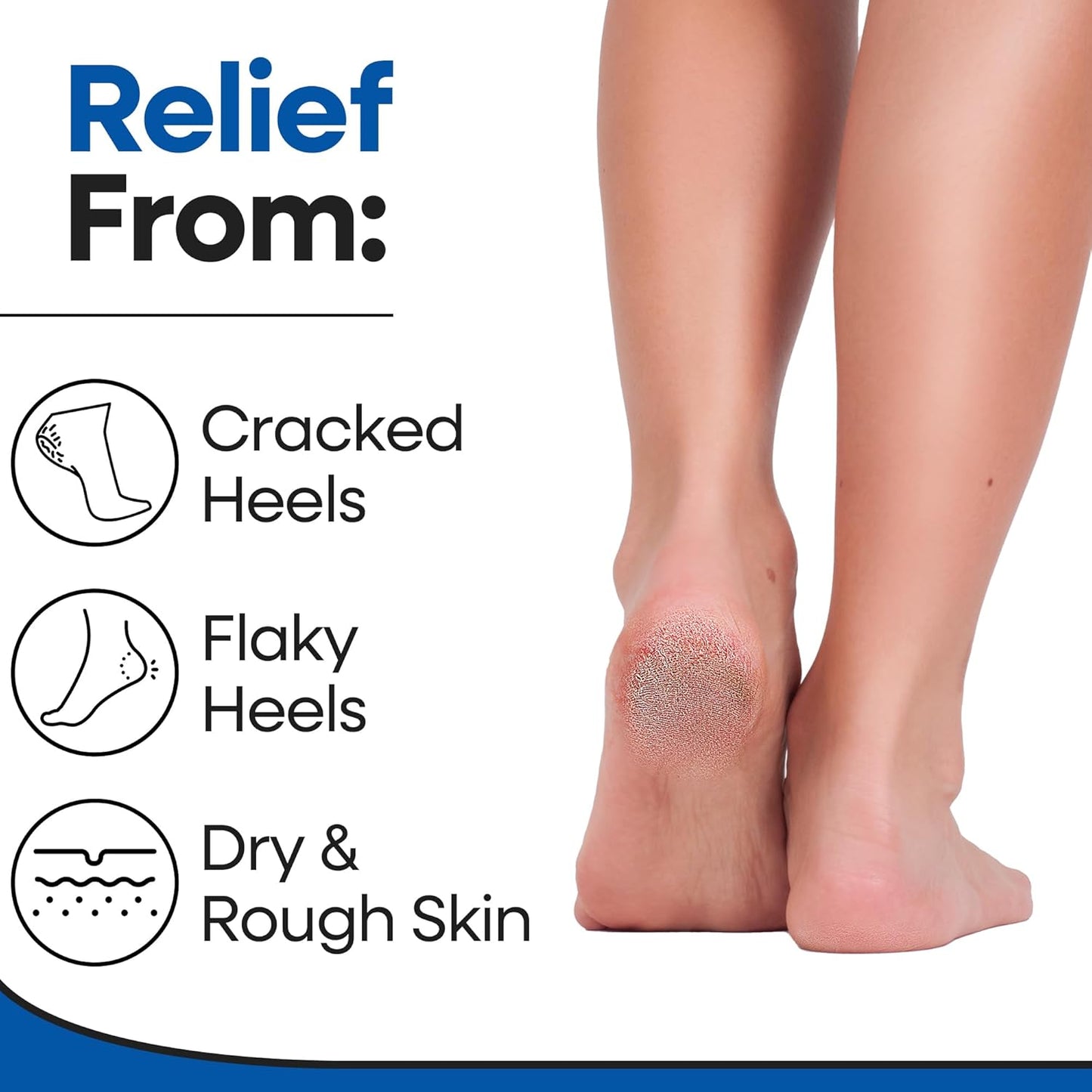 Moisturizing Socks for Women & Men | Cracked Heel Treatment with Aloe Vera | Moisturizer Foot Callus Remover | Aloe Socks for Cracked Heels & Dry Rough Feet, Lotion Infused Gel Heel Sleeves Fits Most