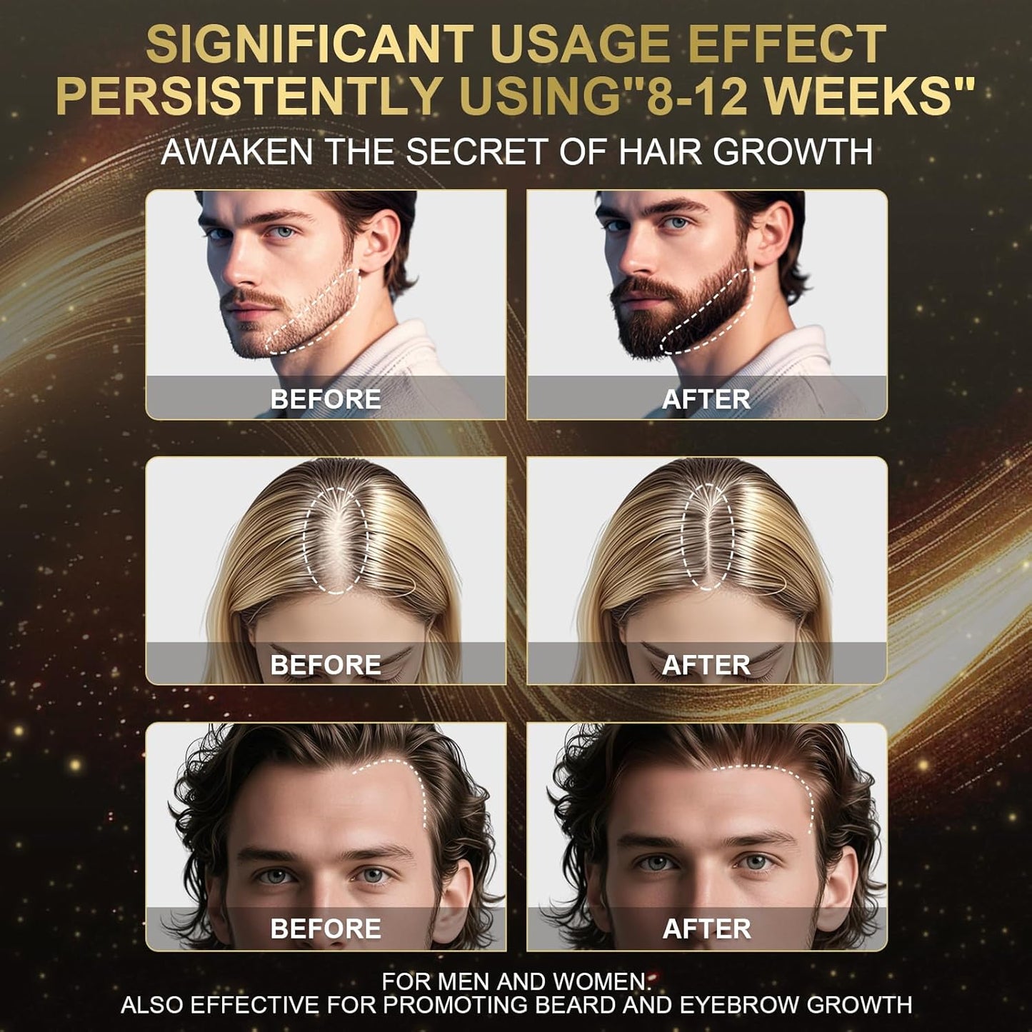 5% Minoxidil Foam for Men & Women - Hair Growth Treatment with Biotin, Non-Greasy Fast Absorbing Foam for Thinning Hair, Regrow Fuller Thicker Hair & Beard, 6 Month Supply (6 x 2.12 oz)