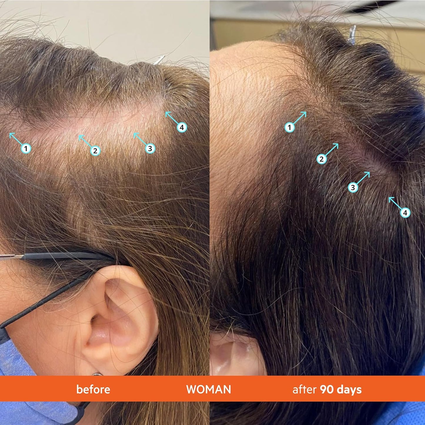 DS Labs Revita Conditioner Travel Size, 100mL - Lightweight, Scalp First Hydration for Fuller Looking, Softer Hair, Thickening Appearance, Sulfate & Silicone Free, Color Safe, For Men & Women